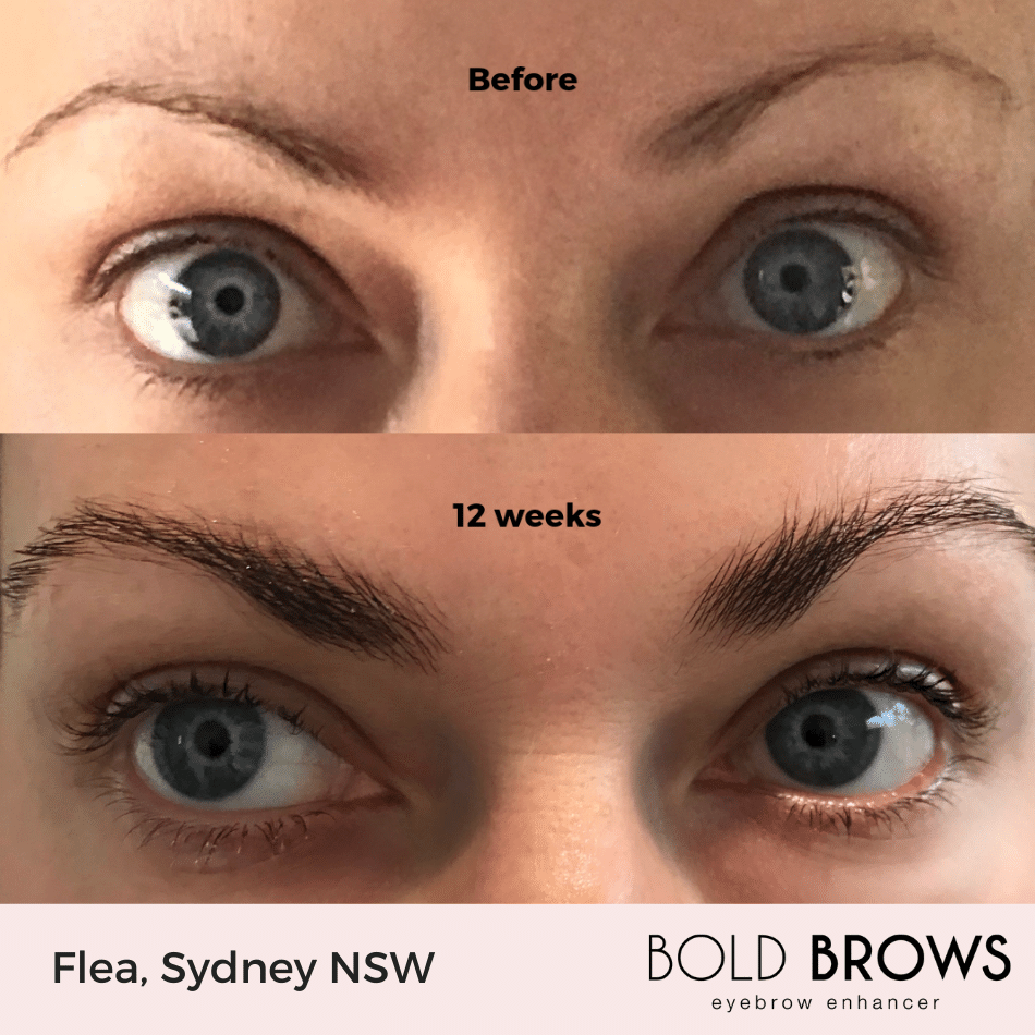 Bold Brows Eyebrow Enhancer